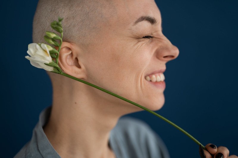 femme ayant perdu ses cheveux
